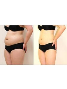 更年期の体の変化と痩身ケアの大切さ